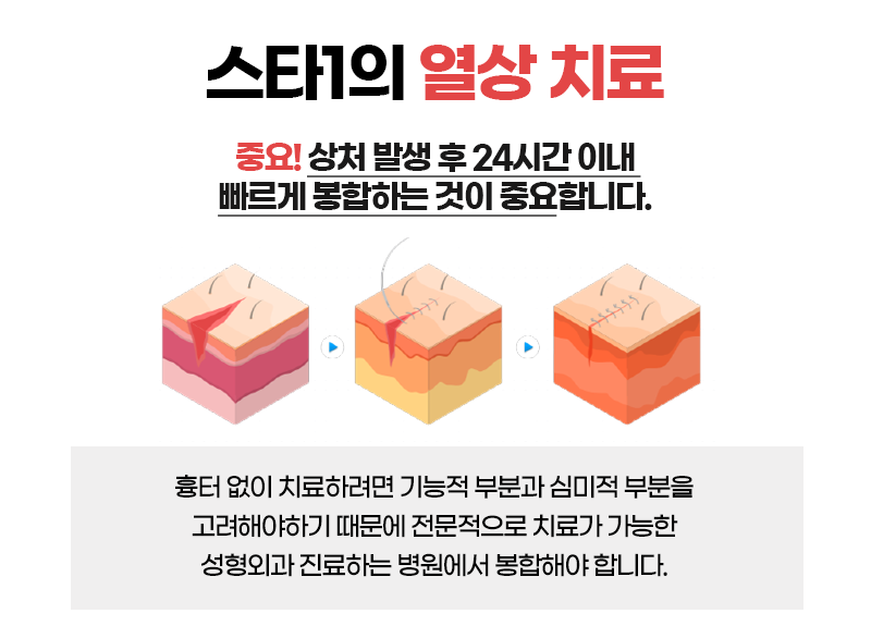 열상치료, 봉합수술 중요한 이유-연신내성형외과 2