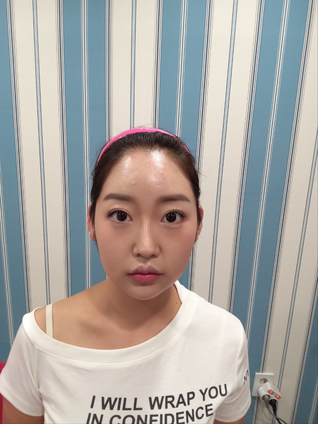 귀필러, 누운귀가 개선되는 방법은 무엇일까? 1